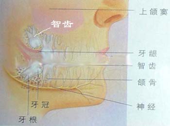 智齿图片你看过了吗？