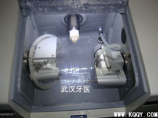 CEREC 3D一小时全瓷修复简介（附临床病例）