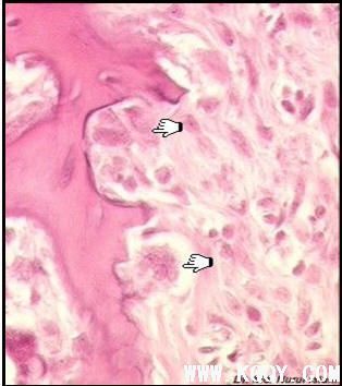 牙槽骨组织切片图