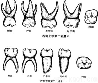 乳牙示意图——右侧上颌第二乳磨牙