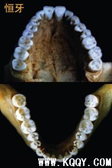 牙齿分类名称——按年龄分类