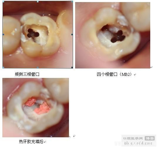 注意！MB2正在悄悄溜走