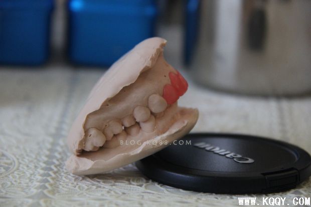 前牙氧化锆美学修复及详细步骤