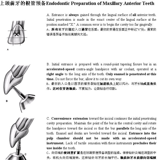 Endo第五版中各牙的牙髓解剖及冠部洞型预备