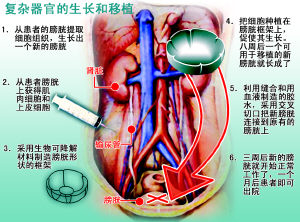 美科学家首次成功再造膀胱组织