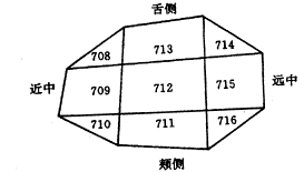 下颌后牙固定桥支持骨组织应力的三维有限元法分析Ⅱ.固定桥桥体下皮质骨的应力分布