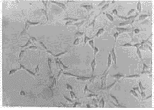 稳定表达骨形成蛋白II型突变受体的NIH3T3细胞的建立及鉴定