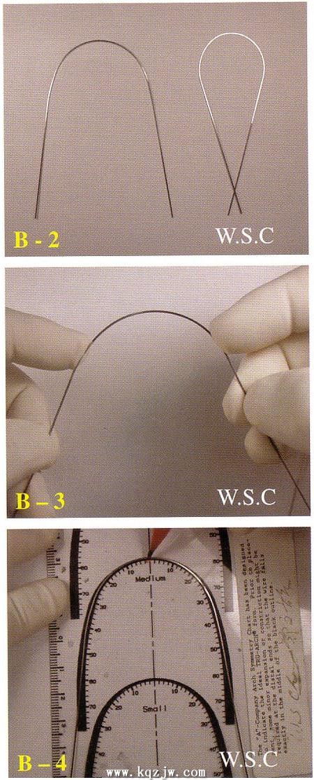 弓丝的弯制是做好矫正的基础一-正畸基础-口腔前沿网